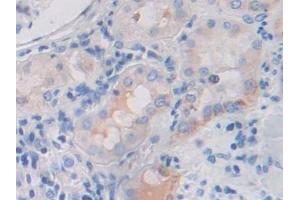 Detection of FGFR3 in Human Kidney Tissue using Polyclonal Antibody to Fibroblast Growth Factor Receptor 3 (FGFR3)