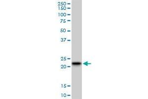 RAB7B monoclonal antibody (M01), clone 3B3. (RAB7B anticorps  (AA 100-199))