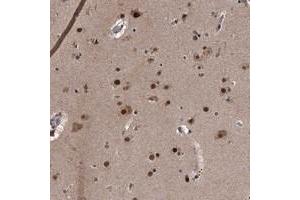 Immunohistochemical staining of human cerebral cortex with ZNF518B polyclonal antibody  shows strong nuclear positivity in neuronal and glial cells. (Zinc Finger Protein 518B (ZNF518B) anticorps)