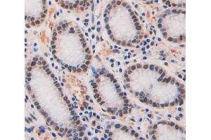 Used in DAB staining on fromalin fixed paraffin- embedded Kidney tissue