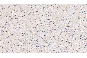Detection of LDHA in Human Cardiac Muscle Tissue using Polyclonal Antibody to Lactate Dehydrogenase A (LDHA)