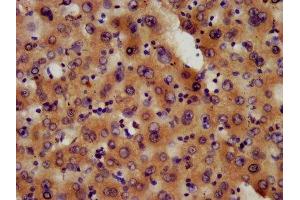 IHC image of ABIN7163609 diluted at 1:600 and staining in paraffin-embedded human liver tissue performed on a Leica BondTM system.
