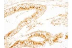 Immunohistochemistry (IHC) image for anti-Protein Kinase, CAMP-Dependent, Regulatory, Type II, alpha (PRKAR2A) (AA 50-100) antibody (ABIN7454771)