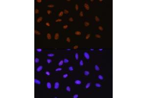 Immunofluorescence analysis of U-2 OS cells using SUMO1 Rabbit mAb  at dilution of 1:100 (40x lens). (SUMO1 anticorps)