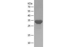 Western Blotting (WB) image for S100 Calcium Binding Protein A9 (S100A9) (AA 1-114) protein (His-IF2DI Tag) (ABIN7124969)