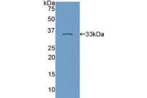 Western blot analysis of recombinant Human PKCe. (PKC epsilon anticorps  (AA 403-672))
