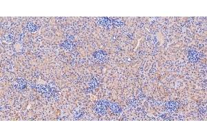 IHC analysis of GLS using anti-GLS antibody (ABIN7601603). (Glutaminase anticorps  (AA 396-654))