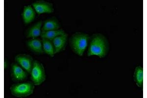 anti-Podocalyxin-Like (PODXL) (AA 32-458) antibody