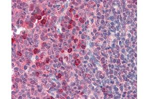 Anti-EXOC3 antibody IHC of human tonsil.