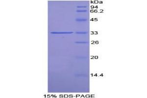 SDS-PAGE analysis of Rat Pim-2 Oncogene Protein. (PIM2 Protéine)
