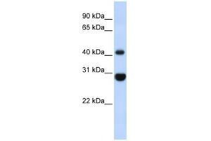 CNP antibody used at 1 ug/ml to detect target protein. (Cnpase anticorps  (Middle Region))