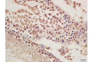 Formalin-fixed and paraffin embedded rat testies labeled with Rabbit Anti-ORP1 Polyclonal Antibody, Unconjugated (ABIN2178099) at 1:200 followed by conjugation to the secondary antibody and DAB staining
