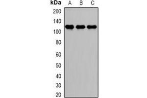 Western blot analysis of DDX58 expression in Jurkat (A), HepG2 (B), MCF7 (C) whole cell lysates. (DDX58 anticorps)