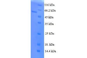 SDS-PAGE (SDS) image for Pituitary Homeobox 3 (PITX3) (AA 1-302), (full length) protein (GST tag) (ABIN5710101)