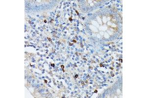 Immunohistochemistry of paraffin-embedded human appendix using RN antibody (ABIN7269987) at dilution of 1:100 (40x lens).