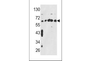 Western blot analysis of CCT3 Antibody (Center) (ABIN389422 and ABIN2839505) in MCF7,CEM,K562,HL-60,Hela cell line lysates (35 μg/lane). (CCT3 anticorps  (AA 298-326))