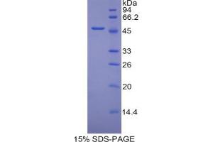 SDS-PAGE analysis of Mouse PECAM1 Protein. (CD31 Protéine)