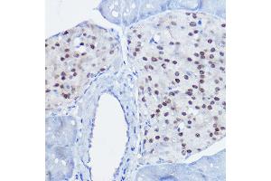 Immunohistochemistry of paraffin-embedded mouse pancreas using NKX6-1 antibody (ABIN7268929) at dilution of 1:50 (40x lens). (NKX6-1 anticorps)