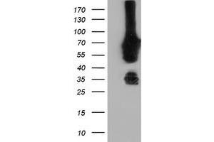 Western Blotting (WB) image for anti-N-Myristoyltransferase 2 (NMT2) antibody (ABIN1499781)