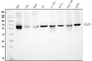 Western blot analysis of KAT9/ELP3 using anti-KAT9/ELP3 antibody (ABIN7602789).