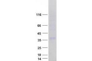 Validation with Western Blot