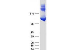 Validation with Western Blot