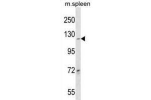 Western Blotting (WB) image for anti-Collagen, Type XIX, alpha 1 (COL19A1) antibody (ABIN3000558)