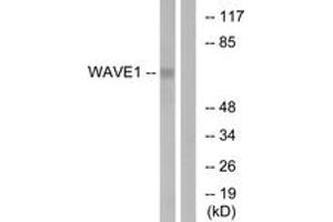 Western blot analysis of extracts from 293 cells, treated with insulin 0. (WASF1 anticorps  (AA 91-140))