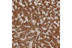 Immunohistochemical staining of human liver with C1orf26 polyclonal antibody  shows distinct cytoplasmic positivity in hepatocytes at 1:200-1:500 dilution. (SWT1 anticorps)