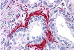 Human Prostate: Formalin-Fixed, Paraffin-Embedded (FFPE) (ATG5 anticorps  (C-Term))