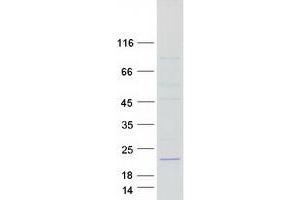 Validation with Western Blot