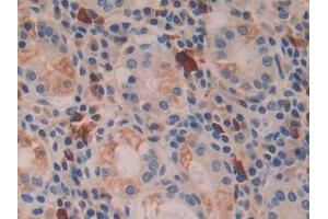 Detection of IFNb in Human Stomach Tissue using Polyclonal Antibody to Interferon Beta (IFNb)