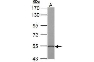WB Image UGDH antibody detects UGDH protein by Western blot analysis.