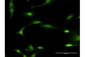 Immunofluorescence of purified MaxPab antibody to FANCL on HeLa cell. (FANCL anticorps  (AA 1-375))