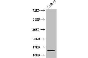 Western Blot Positive WB detected in: Mouse kidney tissue All lanes: MPC2 antibody at 3. (BRP44 anticorps  (AA 1-40))