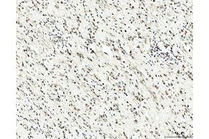 IHC analysis of RRP4/EXOSC2 using anti-RRP4/EXOSC2 antibody (ABIN7602188). (EXOSC2 anticorps  (AA 62-293))