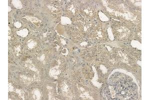 ABIN6254978 and ABIN6274033 at 1/100 staining human normal kidney tissue by IHC-P.