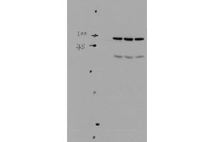 Western blot analysis of Mouse kidney tissue lysates showing detection of ENaC protein using Rabbit Anti-ENaC Polyclonal Antibody . (SCNN1A anticorps  (AA 46-68) (PerCP))