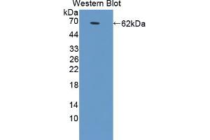 Western blot analysis of the recombinant protein. (GRIA2 anticorps  (AA 25-543))