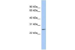LYPD5 antibody used at 1 ug/ml to detect target protein. (LYPD5 anticorps  (N-Term))