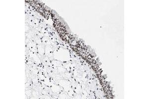 Immunohistochemical staining of human nasopharynx with VEZF1 polyclonal antibody  shows moderate nuclear positivity in respiratory epithelial cells at 1:10-1:20 dilution.