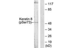 Western blot analysis of extracts from 293 cells treated with Etoposide 25uM 60', using Keratin 8 (Phospho-Ser73) Antibody. (KRT8 anticorps  (pSer73))