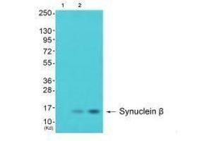 Western blot analysis of extracts from 293 cells (Lane 2) and cos-7 cells (Lane 3), using Synuclein β antiobdy. (beta Synuclein anticorps)