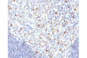 IHC analysis of FFPE human tonsil tissue and IgM antibody (MuHC2) (Souris anti-Humain IgM Anticorps)