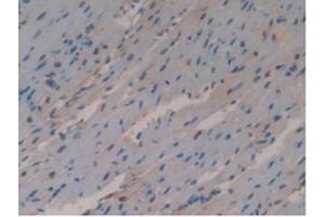 Detection of GSTo1 in Mouse Heart Tissue using Polyclonal Antibody to Glutathione S Transferase Omega 1 (GSTo1)