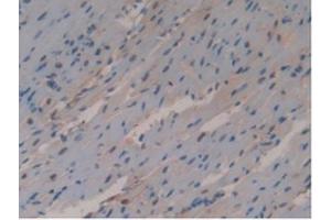 Detection of GSTo1 in Mouse Heart Tissue using Polyclonal Antibody to Glutathione S Transferase Omega 1 (GSTo1) (GSTO1 anticorps  (AA 24-233))