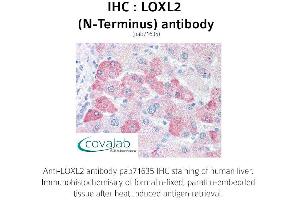 Image no. 1 for anti-Lysyl Oxidase-Like 2 (LOXL2) (N-Term) antibody (ABIN1736517)