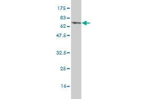 Western Blot detection against Immunogen (70. (PHKG2 anticorps  (AA 1-406))