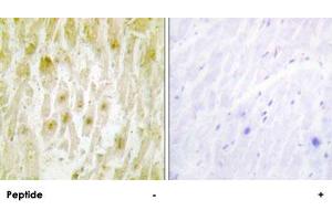 Immunohistochemistry analysis of paraffin-embedded human heart tissue using GTF2E2 polyclonal antibody . (GTF2E2 anticorps)