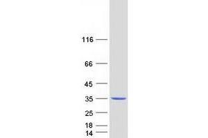 Validation with Western Blot